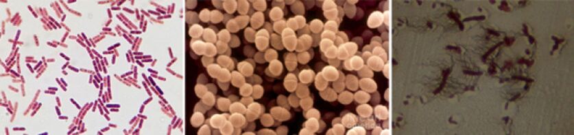 Escherichia štapići, fekalni enterokok i pro - glavni patogeni kroničnog bakterijskog prostatitisa