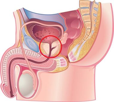 Lokacija prostate kod muškaraca