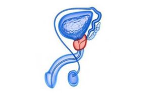 crtež upale prostate